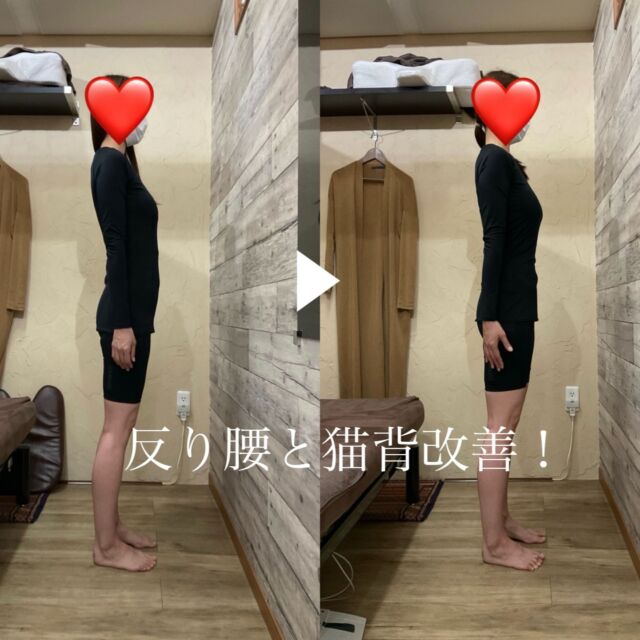 O脚矯正・美脚矯正コース | 千葉の美容整体・美容鍼サロン.com